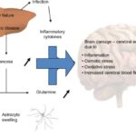 Putative mechanisms underlying hyperammonemia encephalopathy and brain edema